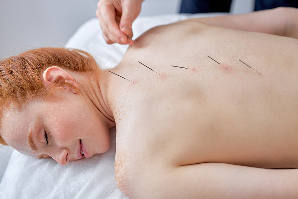 acupuncture-painful-periods